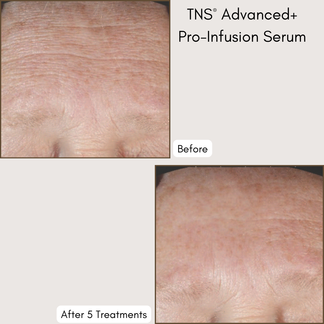 DiamondGlow® Dermalinfusion Facial
