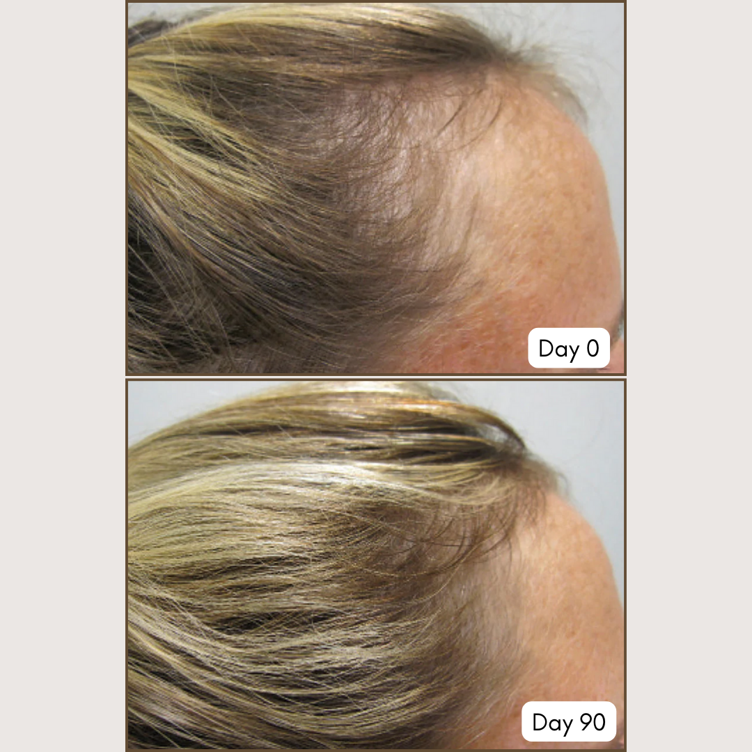 Viviscal PRO Professional Hair Growth Supplements