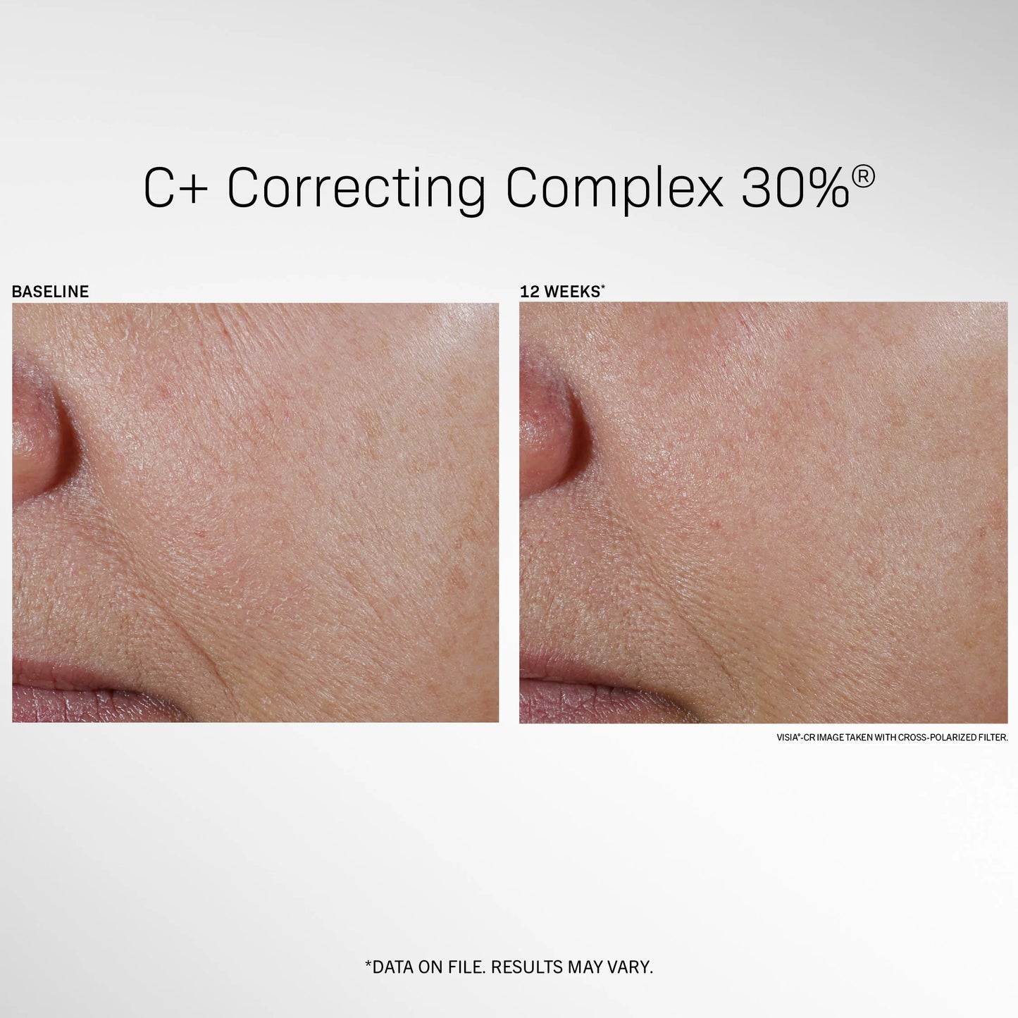 C+ Correcting Complex 30%®