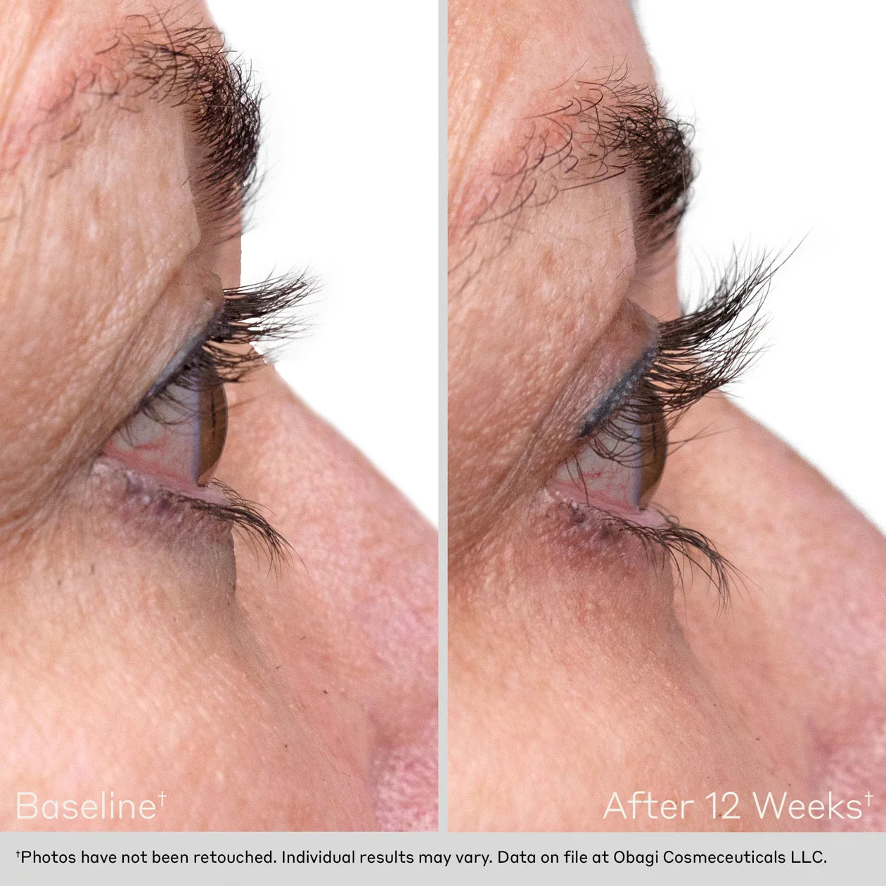 Obagi® Lash and Brow Serum Set