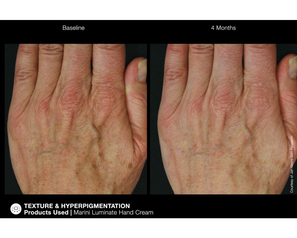 Marini ReNu Corrective Hand Complex