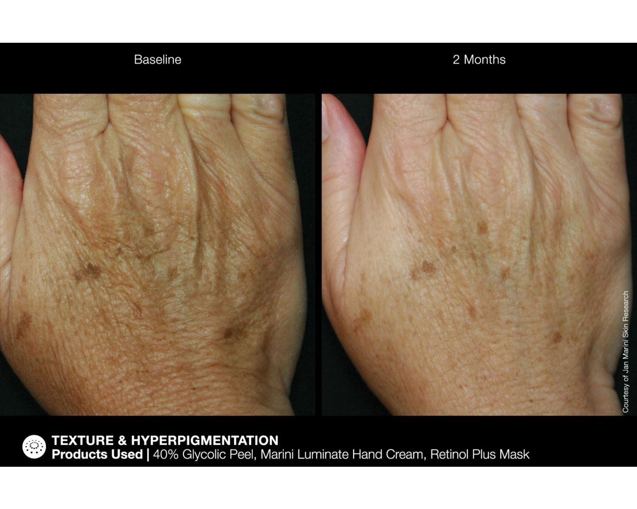 Marini ReNu Corrective Hand Complex