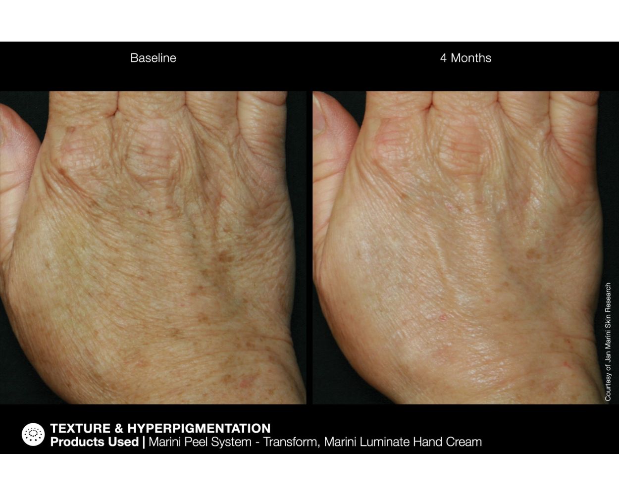 Marini ReNu Corrective Hand Complex