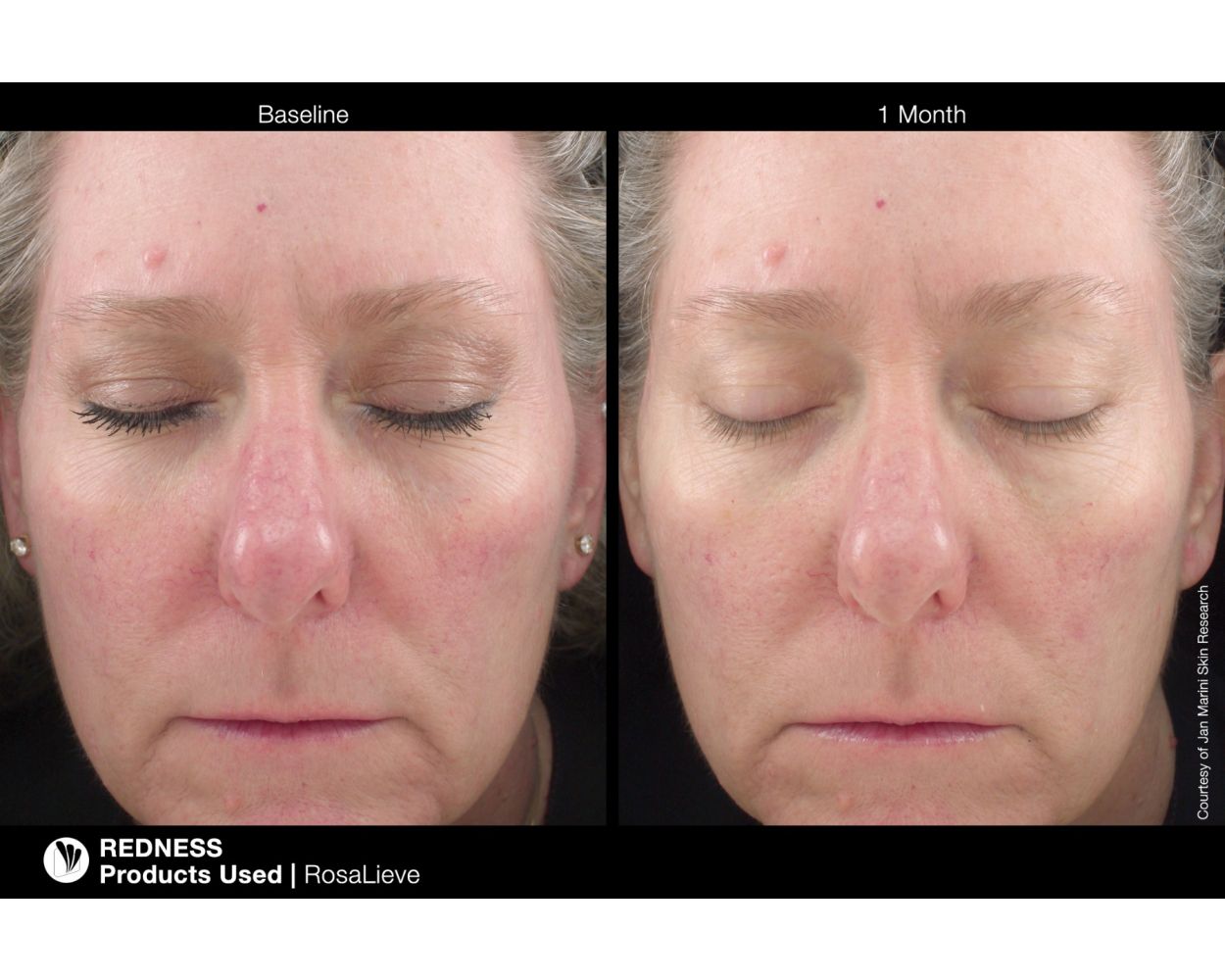 RosaLieve® Redness Reducing Complex