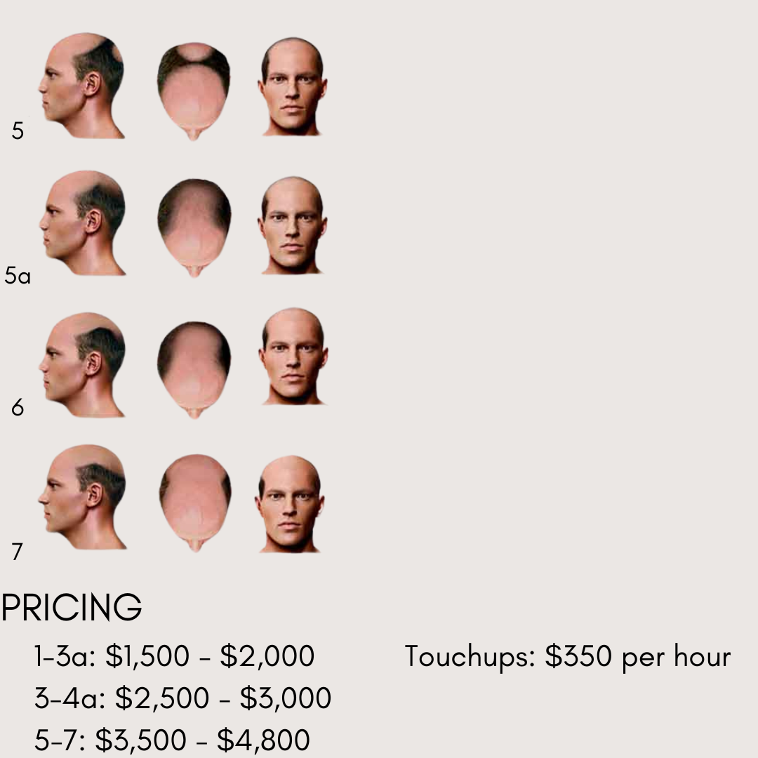 Male Scalp Micropigmentation®